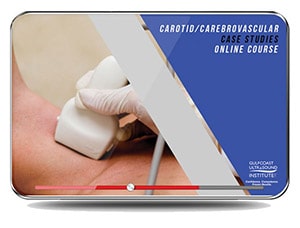 Carotid/Cerebrovascular Case Studies